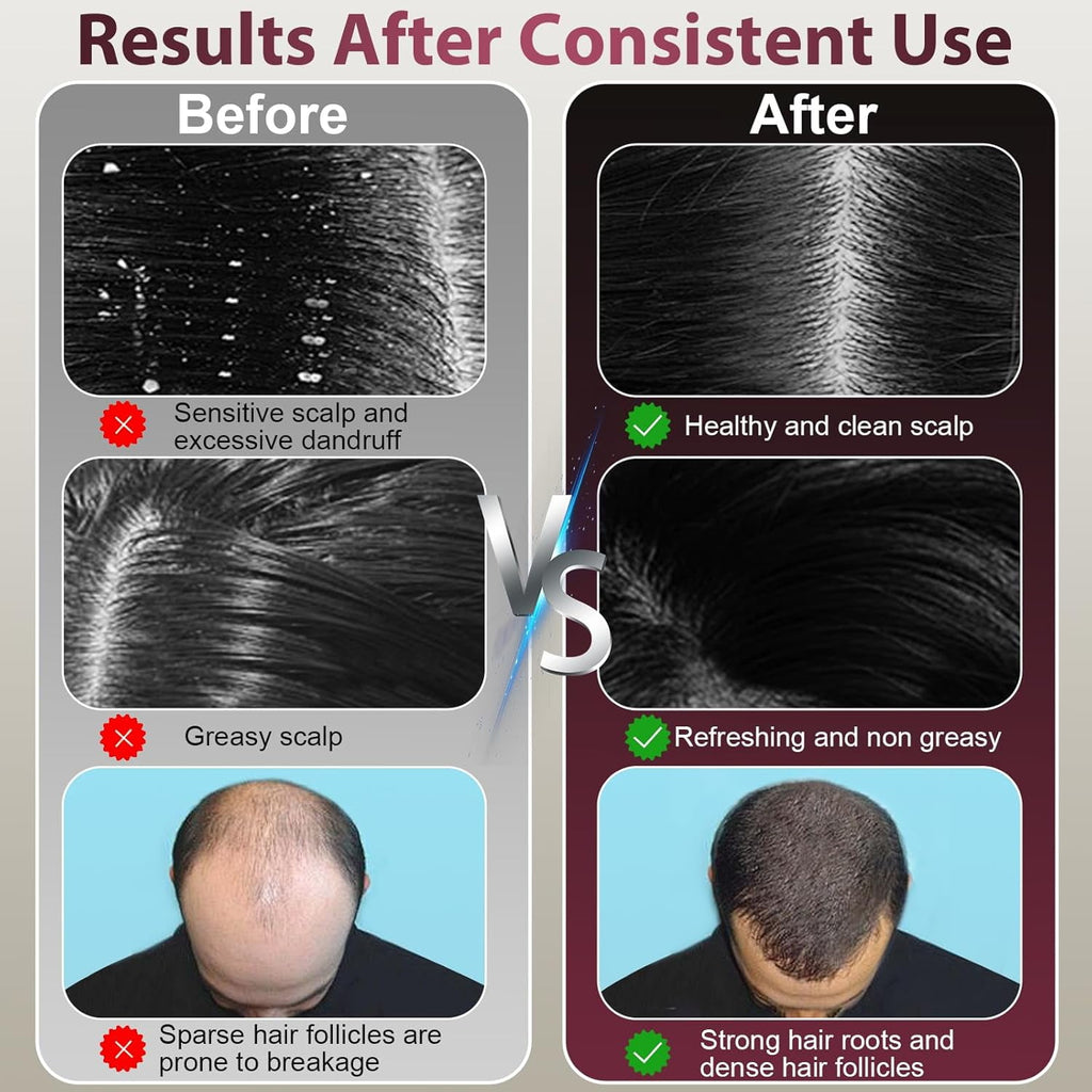 3-in-1 Comb for Men with 630nm Red Light Therapy, Scalp Massager Brush, Oil Applicator, 72 Teeth & 8 Roller Balls, Re... - Image 3